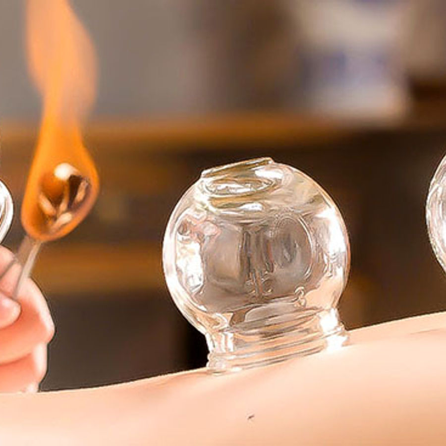 Cupping